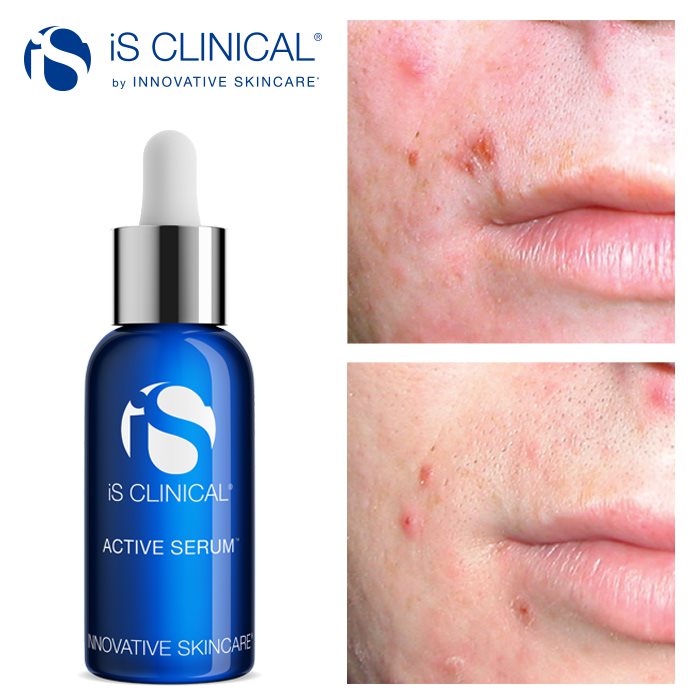 Active Serum 30 ml